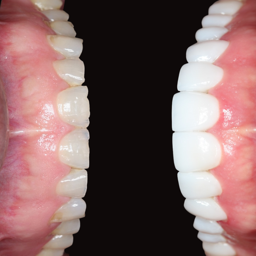 Before and after