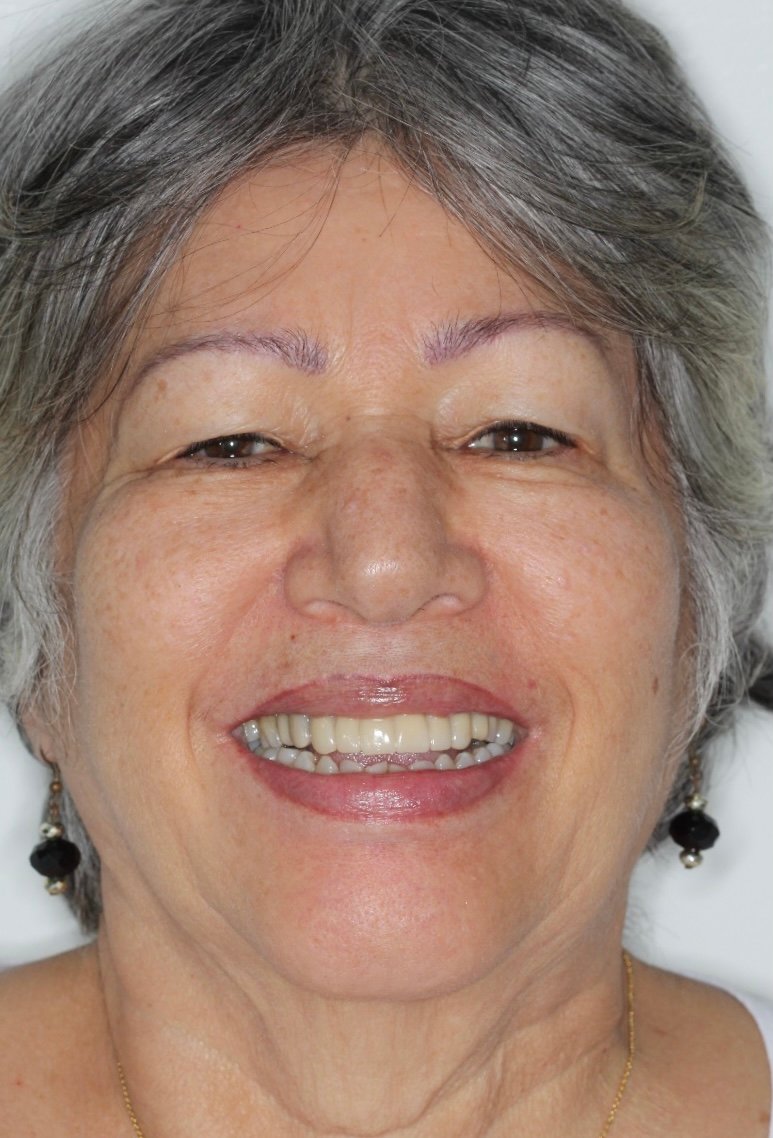 Luz Elena Velez after