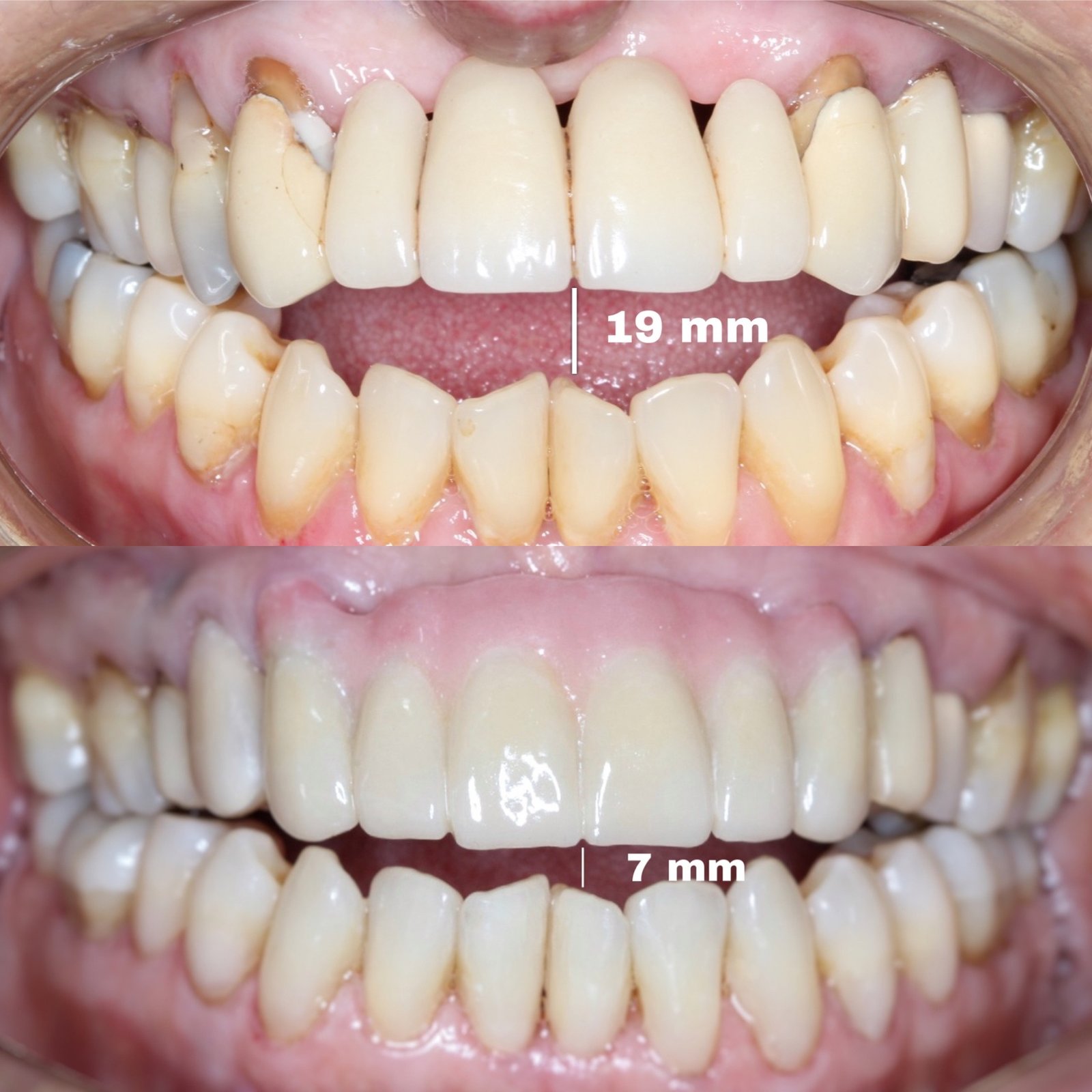 Luz Elena Velez teeth