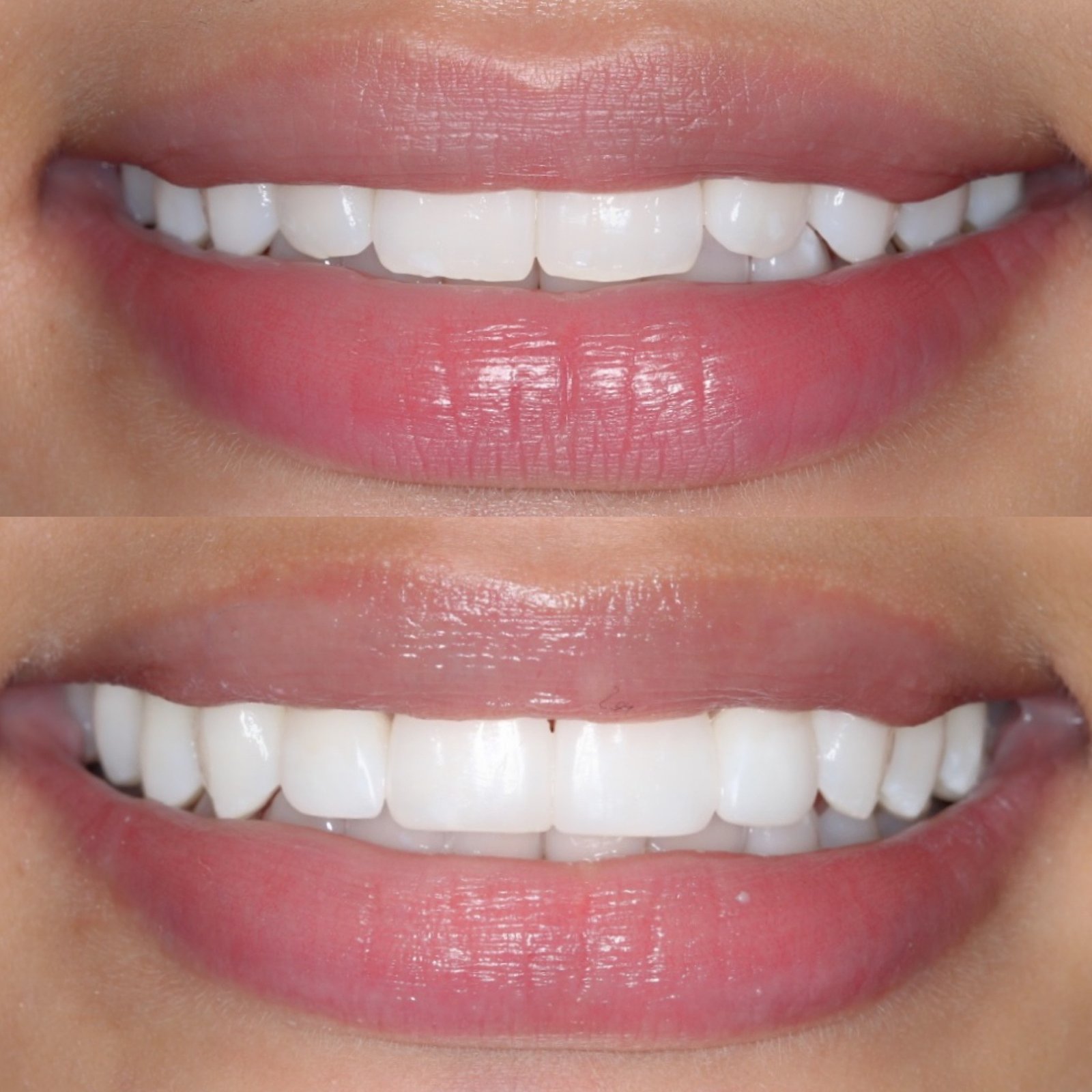 before and after beautiful changes