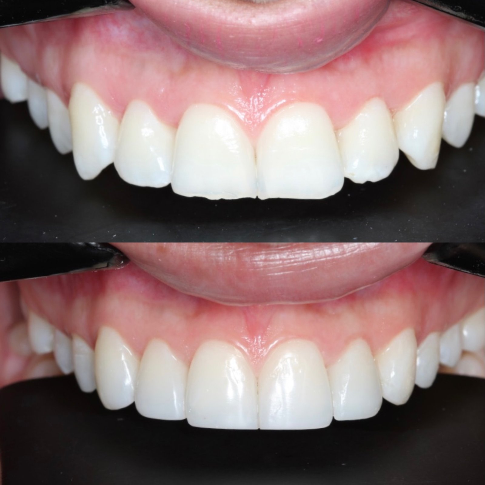 this is for you before and after